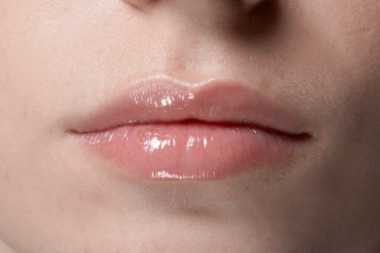 Petroleum jelly uses : Lip softener