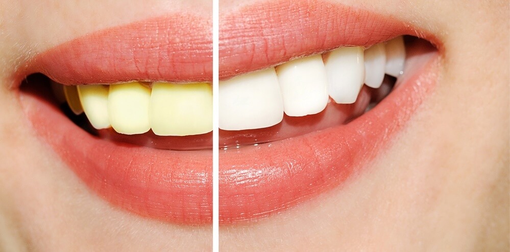 Petroleum jelly uses : Tooth polisher